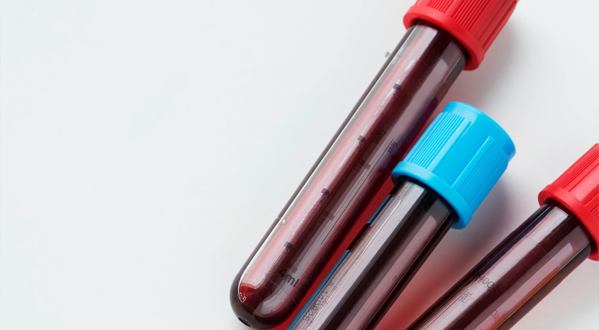 analiticas de glucosa colesterol farmacia barajas madrid